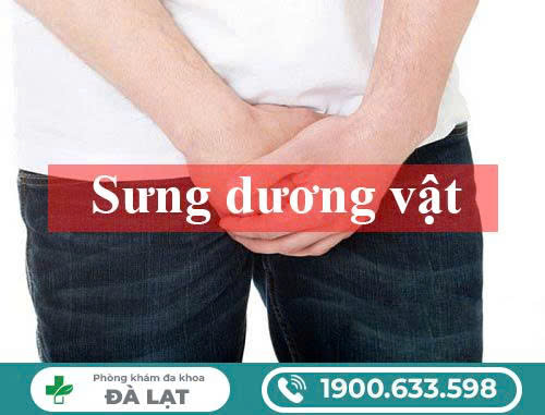 Hình ảnh minh họa